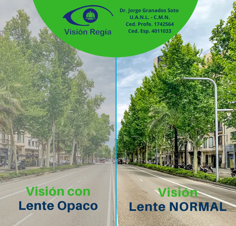 lenteopacomty