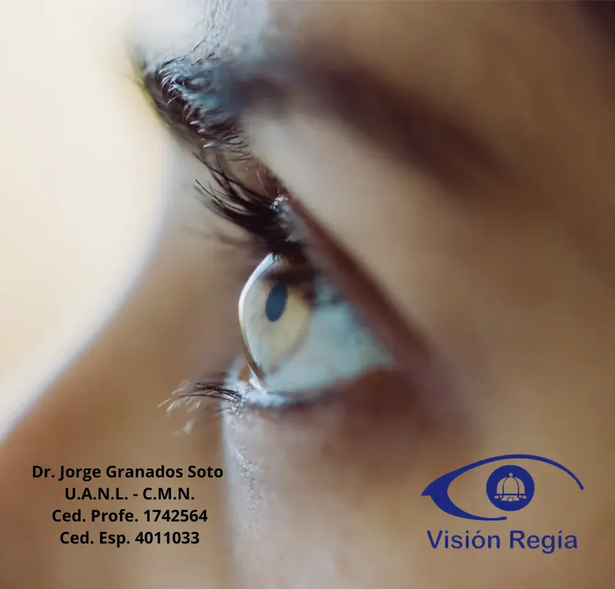 ojitoqueratocono (1)